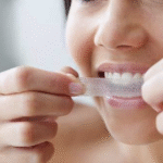 How To Create White Teeth For Your Wedding Day