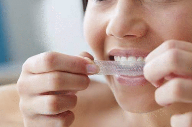 How To Create White Teeth For Your Wedding Day
