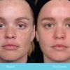 Glowing, Clear and Blemish-Free Skin for the 30+ Bride – Part 1